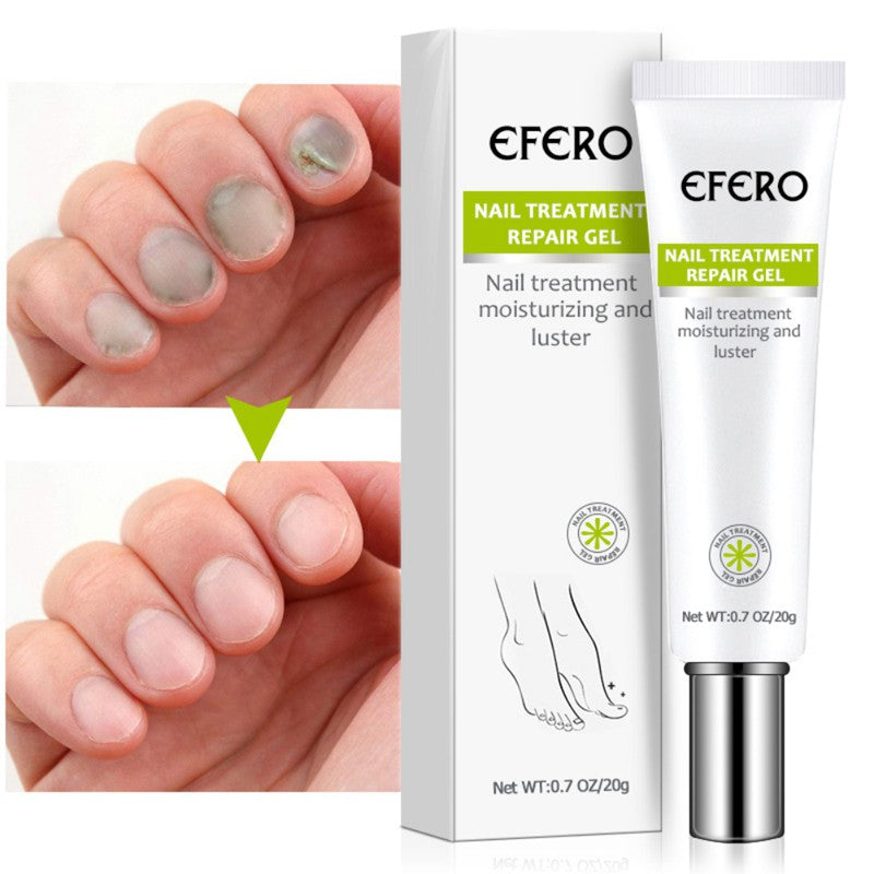 Efero Cream - Creme Para Remoção de Fungos - viya-stores
