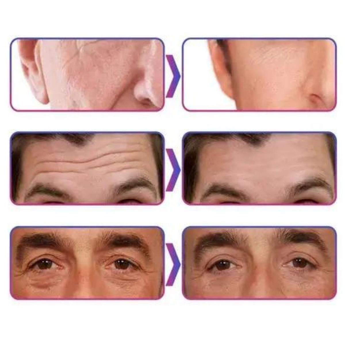 Creme Facial Anti-Idade Masculino – New Skin - viya-stores