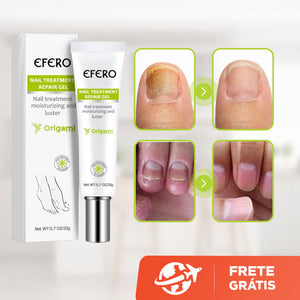 Efero Cream - Creme Anti-Inflamatório Para Remoção de Fungos - viya-stores