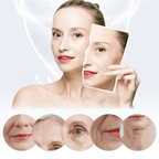 Collagen Skin Botox™ - Colágeno + Ácido Hialurônico OFERTA 🎁 (50% DE DESCONTO) + BRINDE