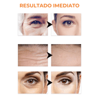 Collagen Skin Botox™ - Colágeno + Ácido Hialurônico OFERTA 🎁 (50% DE DESCONTO) + BRINDE