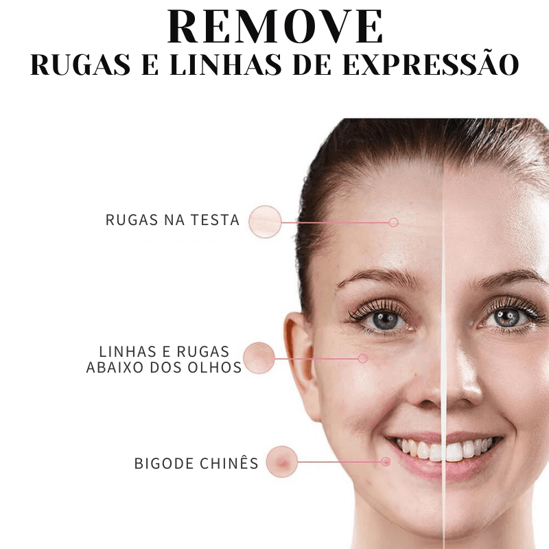 Collagen Skin Botox™ - Colágeno + Ácido Hialurônico OFERTA 🎁 (50% DE DESCONTO) + BRINDE