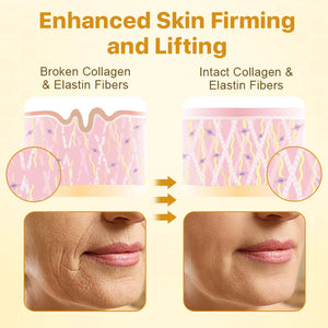 BotoxLux Creme Lifting de Veneno de Abelha PROMOÇÃO DE PÁSCOA ( LEVE 2 )
