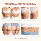 Drena Roller – Massageador Linfático para Lipedema e Celulite
