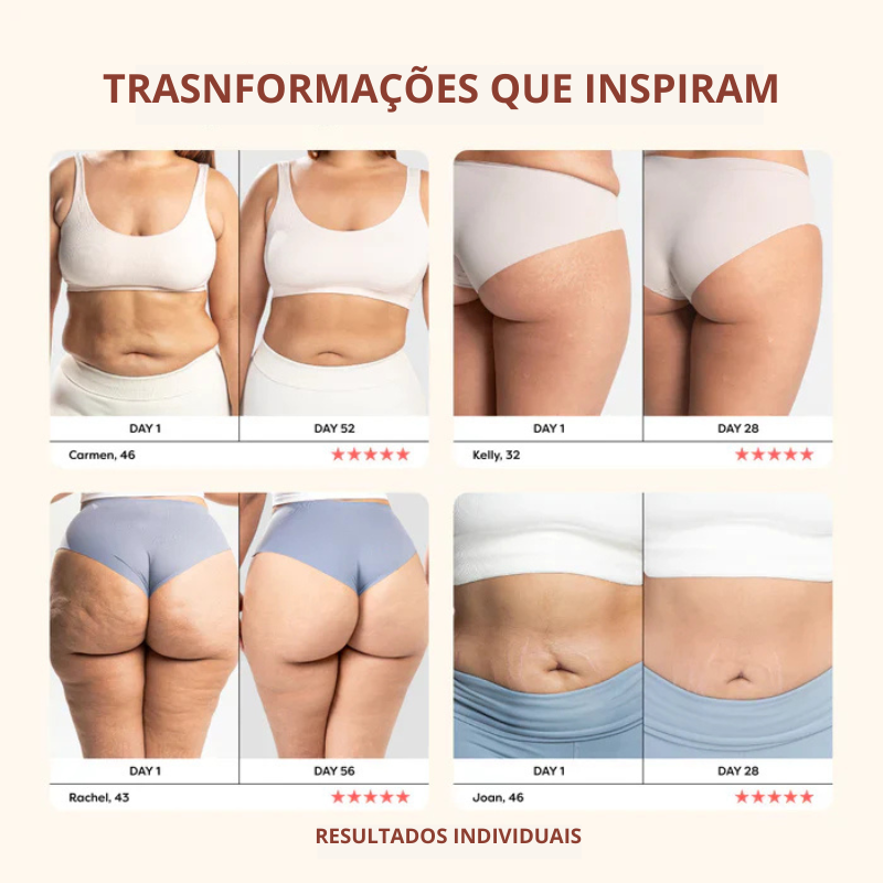 Drena Roller – Massageador Linfático para Lipedema e Celulite