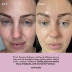 Wrinkle Retreat Red Light Therapy Face Mask