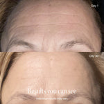 Wrinkle Retreat Face Mask & LightBoost Serum Kit