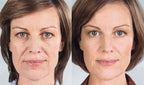 BotoxLux™ Creme Lifting com Peptídeos