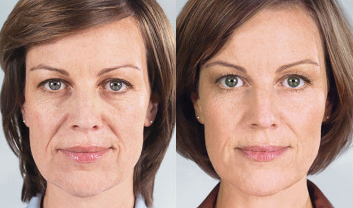 BotoxLux™ Creme Lifting com Peptídeos