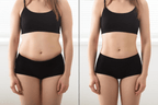 Adesivo de Umbigo para Emagrecimento - Saúde Detox