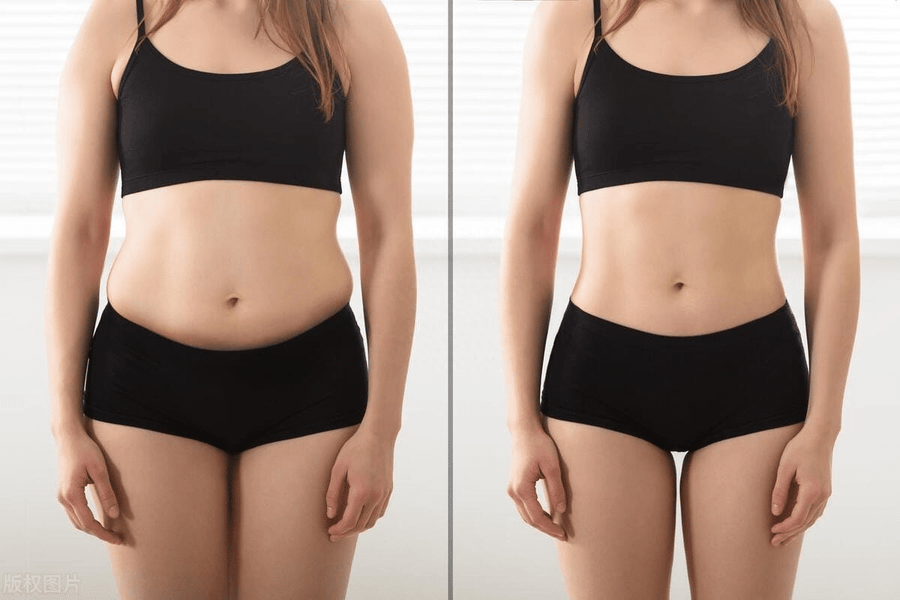 Adesivo de Umbigo para Emagrecimento - Saúde Detox