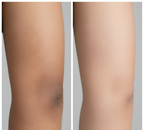 ViyaWhite™ Creme Corporal Clareador