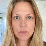 4-in-1 Red Light Therapy Wand & Activating Serum Kit