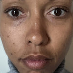 4-in-1 Red Light Therapy Wand & Activating Serum Kit