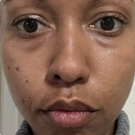 4-in-1 Red Light Therapy Wand & Activating Serum Kit