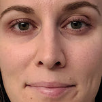 4-in-1 Red Light Therapy Wand & Activating Serum Kit