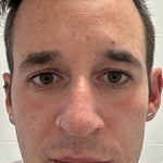 4-in-1 Red Light Therapy Wand & Activating Serum Kit