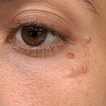 4-in-1 Red Light Therapy Wand & Activating Serum Kit