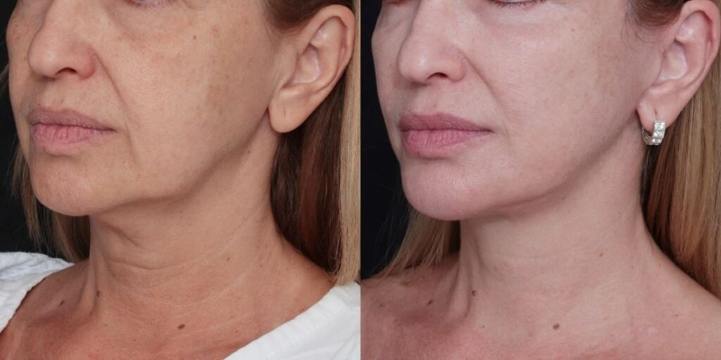 Creme Rejuvenescedor Anti-Age - Anti Manchas & Expressões™