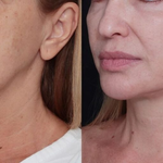 Creme Rejuvenescedor Anti-Age - Anti Manchas & Expressões™