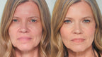 Base ViyaWhite™  - Fórmula Rejuvenescedora