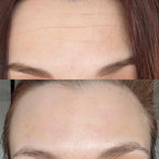 Retinal Cream™ | Creme Facial Firmador com Retinal