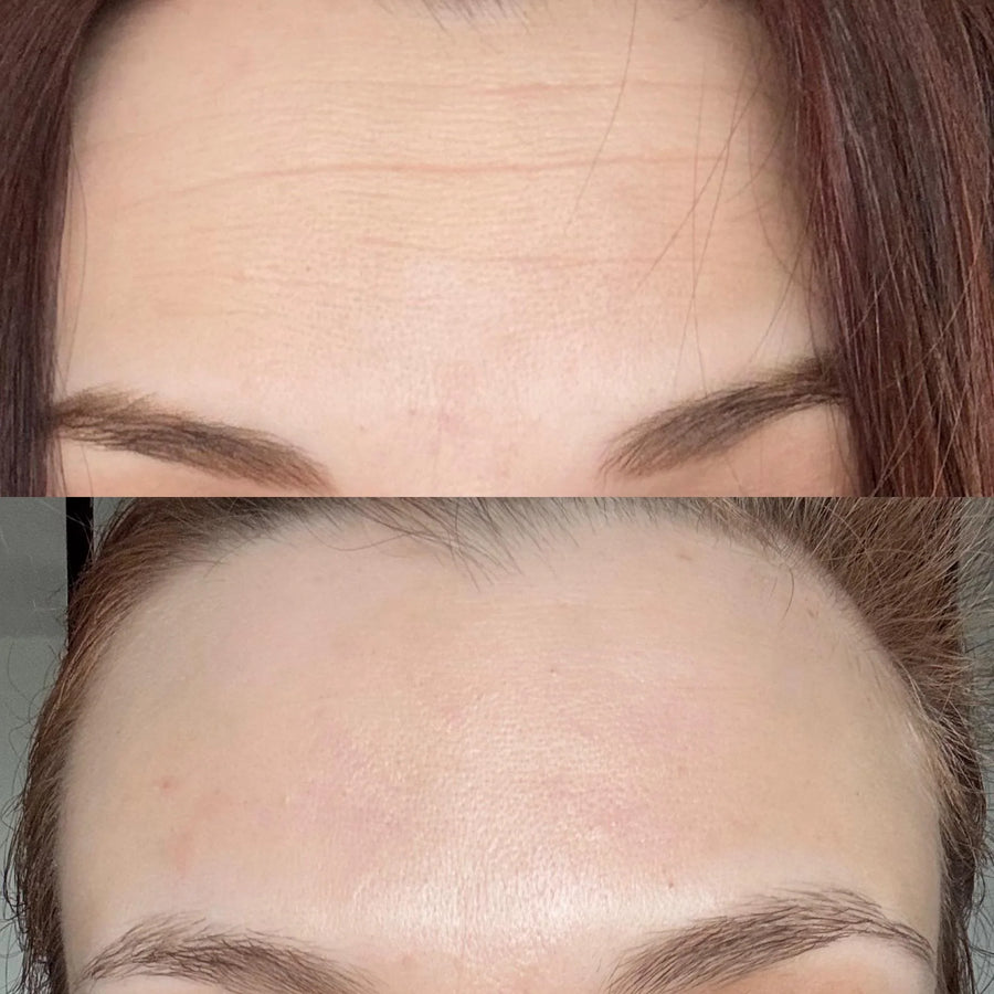 Retinal Cream™ | Creme Facial Firmador com Retinal