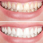 Clareador Dental Viya White  - PROMOÇÃO DE PÁSCOA (50% DE DESCONTO)