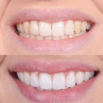 Clareador Dental Viya White  - PROMOÇÃO DE PÁSCOA (50% DE DESCONTO)