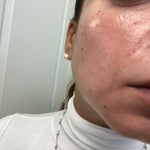 Aparelho Peeling Ultrassônico Limpeza Facial – Pele Radiante - viya-stores