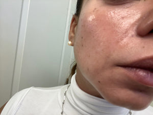 Aparelho Peeling Ultrassônico Limpeza Facial – Pele Radiante - viya-stores