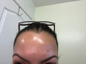 Aparelho Peeling Ultrassônico Limpeza Facial – Pele Radiante - viya-stores