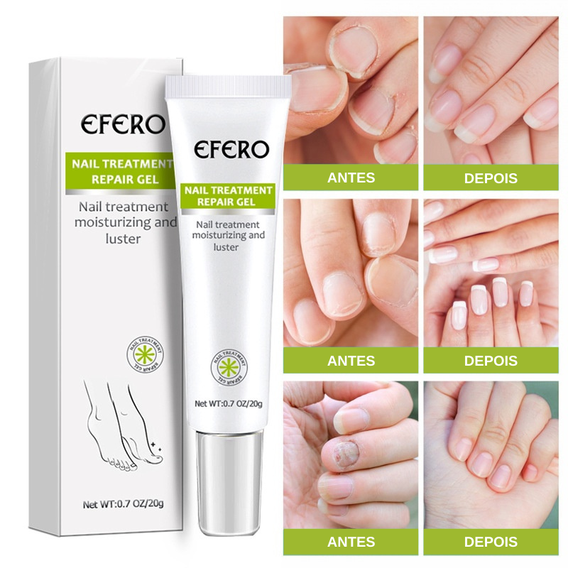 Efero Cream - Creme Para Remoção de Fungos - viya-stores