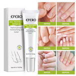Efero Cream - Creme Para Remoção de Fungos - viya-stores