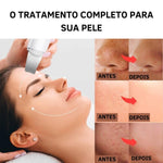 Aparelho Peeling Ultrassônico Limpeza Facial – Pele Radiante - viya-stores