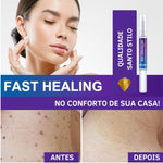 Creme Removedor de Verrugas – Fast Healing - viya-stores