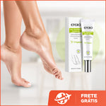 Efero Cream - Creme Para Remoção de Fungos - viya-stores