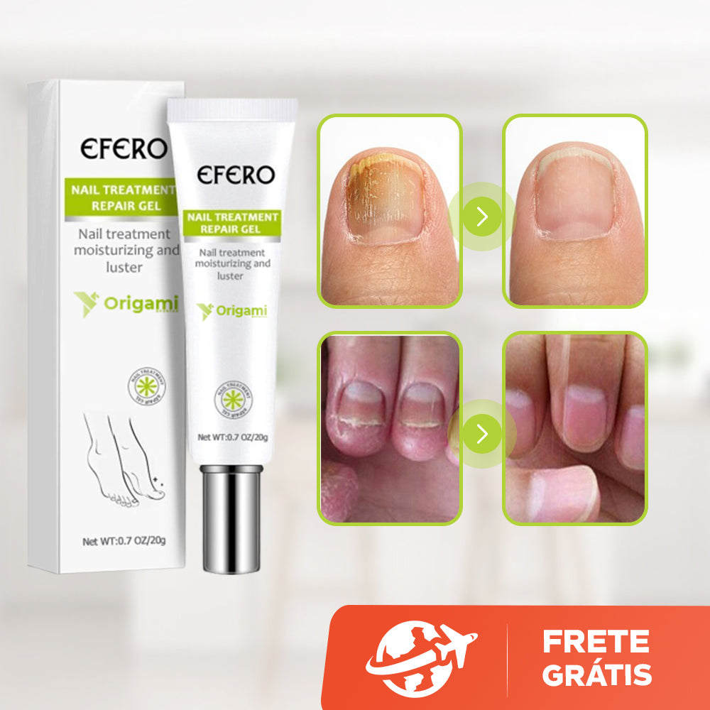 Efero Cream - Creme Para Remoção de Fungos - viya-stores