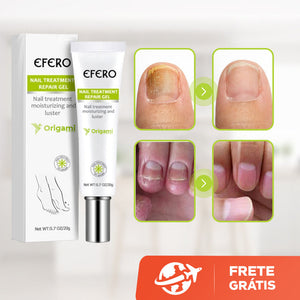 Efero Cream - Creme Para Remoção de Fungos - viya-stores
