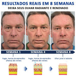 Cópia de Creme HIMSE© - Removedor de bolsas e olheiras