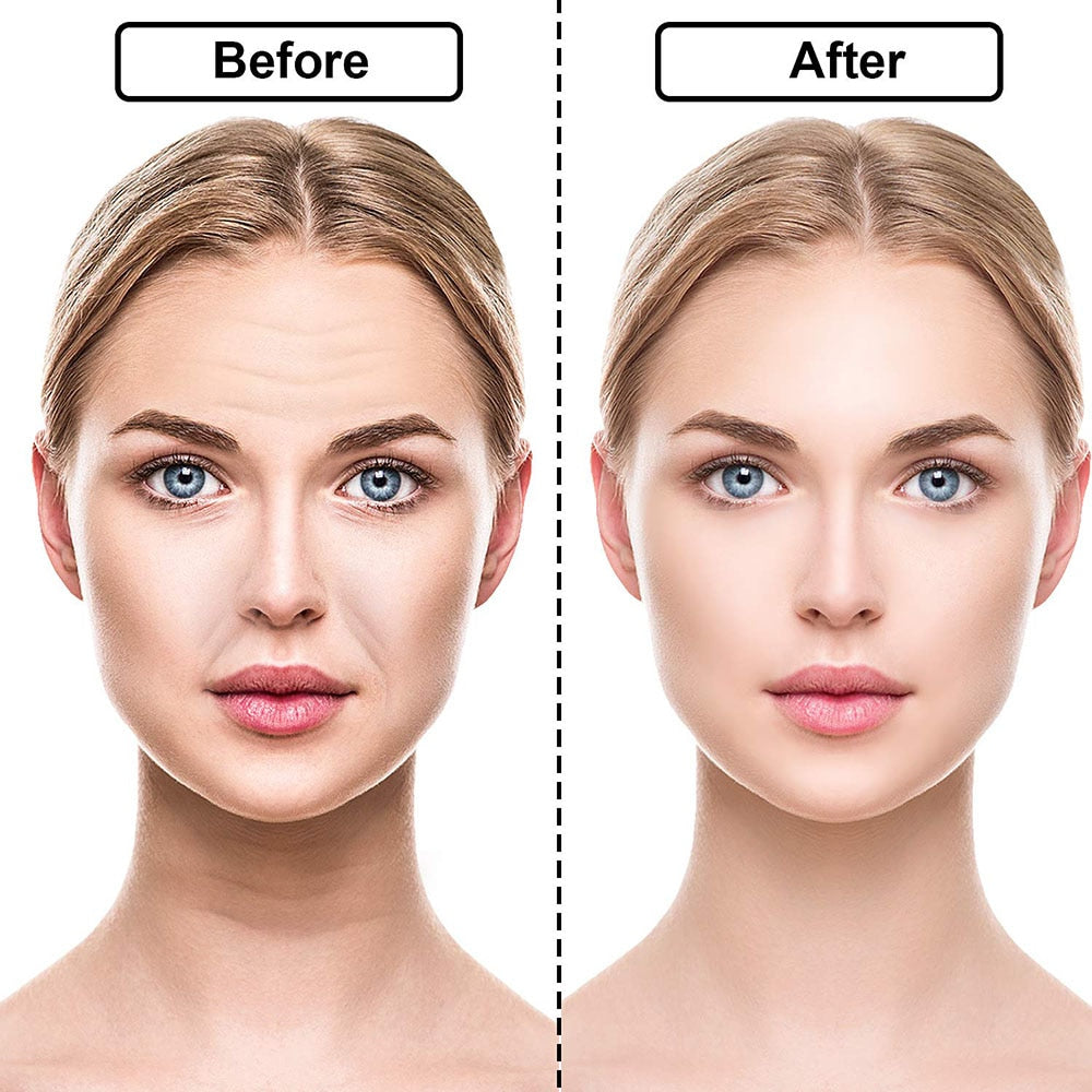Adesivos de Silicone Anti Rugas e Linhas de Expressão - RevonaSkin™ - viya-stores
