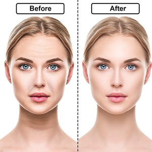 Adesivos de Silicone Anti Rugas e Linhas de Expressão - RevonaSkin™ - viya-stores