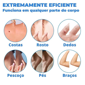 Creme Removedor de Verrugas – Fast Healing - viya-stores