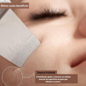 Aparelho Peeling Ultrassônico Limpeza Facial – Pele Radiante - viya-stores