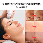Aparelho Peeling Ultrassônico Limpeza Facial – Pele Radiante - viya-stores