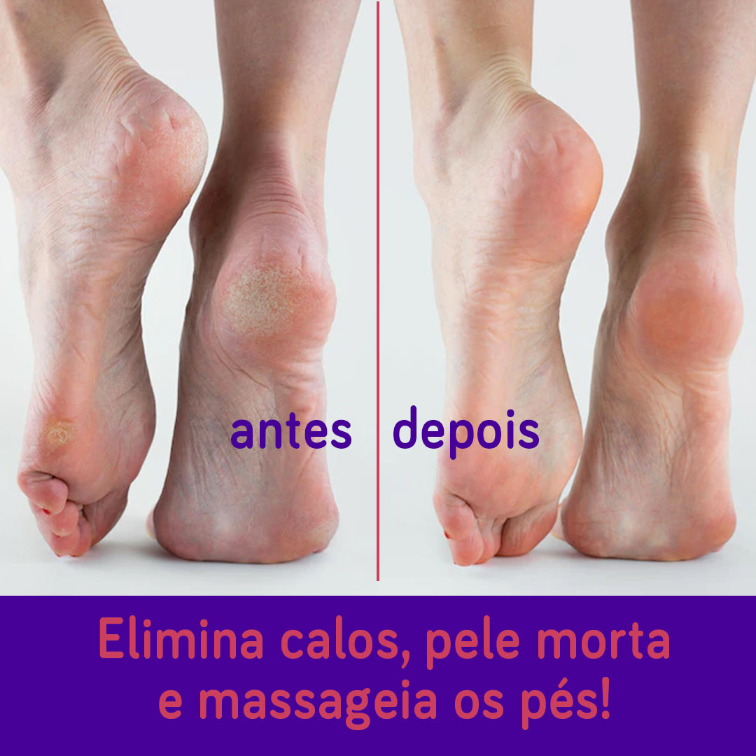 Lixa para Pés Bonitos e Saudáveis – Pedicuro Velvety Feet - viya-stores