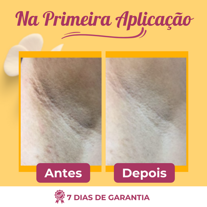 Retinou™ Creme Para Clareamento, Retire a Manchas Excessivas de Qualquer Região - Promoção Pré-Black Friday - viya-stores