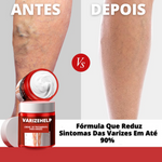 Creme Para Varizes Efeito Imediato VarizeHelp - viya-stores