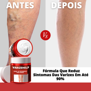 Creme Para Varizes Efeito Imediato VarizeHelp - viya-stores