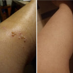 Creme Removedor de Verrugas – Fast Healing - viya-stores